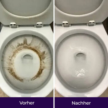 NuroClean image