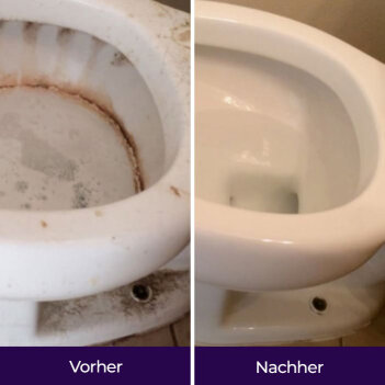 NuroClean image