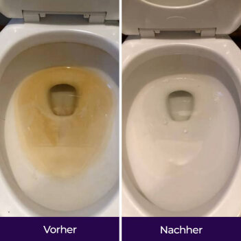 NuroClean image